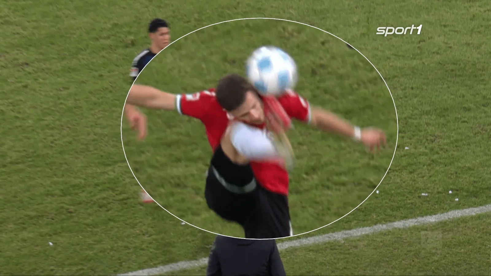 Le joueur de Bundesliga 2 a quitté sanglant et a besoin d’un traitement après s’être donné au visage